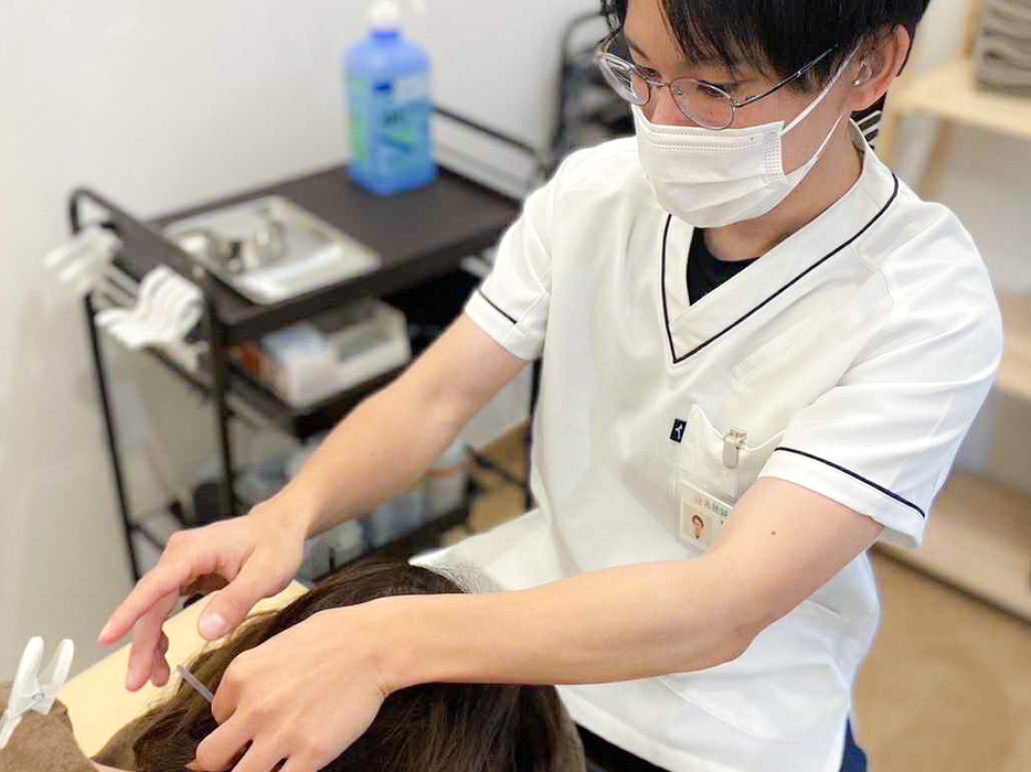腰の鍼治療の風景（男性の背中）